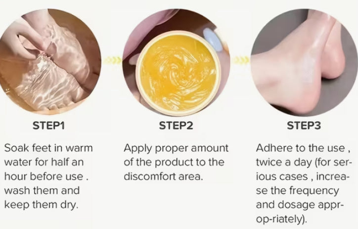 Secret cracked skin ointment